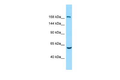 Western Blot: EHM2 Antibody [NBP2-84843]
