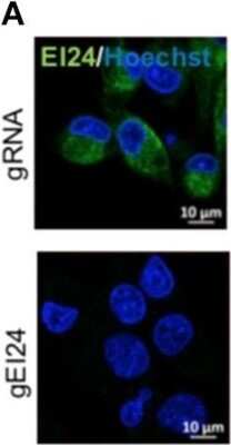 Immunocytochemistry/ Immunofluorescence: EI24 Antibody [NBP2-13949]