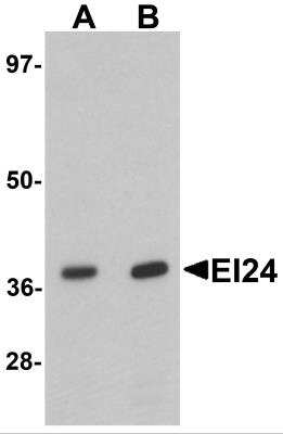 Western Blot: EI24 AntibodyBSA Free [NBP2-81820]