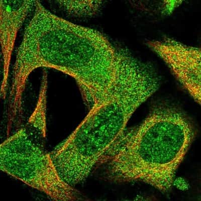 Immunocytochemistry/ Immunofluorescence: EI2BL Antibody [NBP2-47475]