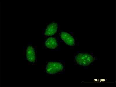 Immunocytochemistry/ Immunofluorescence: EID1 Antibody [H00023741-B01P]