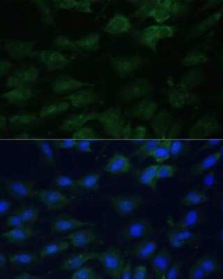 Immunocytochemistry/ Immunofluorescence: EIF1A Antibody - BSA Free [NBP2-92896]