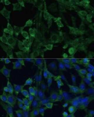 Immunocytochemistry/ Immunofluorescence: EIF1A Antibody - BSA Free [NBP2-92896]