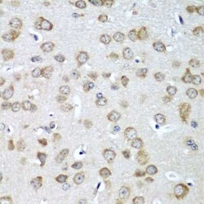 Immunohistochemistry-Paraffin: EIF1A Antibody - BSA Free [NBP2-92896]