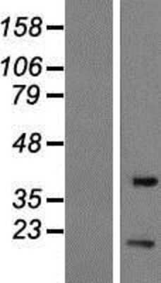 Western Blot: EIF1B Overexpression Lysate [NBP2-07692]