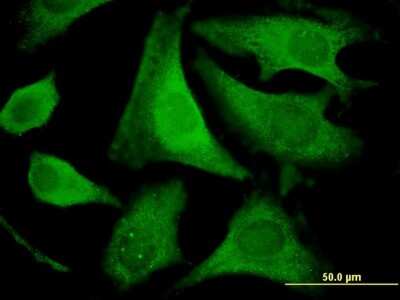 Immunocytochemistry/ Immunofluorescence: EIF2 beta Antibody (2F3) [H00008894-M09]