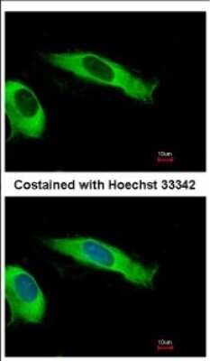 Immunocytochemistry/ Immunofluorescence: EIF2 beta Antibody [NBP2-16290]