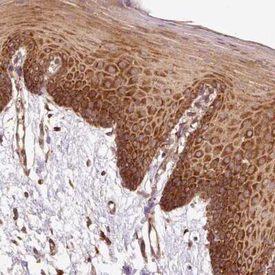 Immunohistochemistry: EIF2 beta Antibody [NBP2-38483]