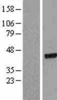 Western Blot: EIF2 beta Overexpression Lysate [NBL1-10187]