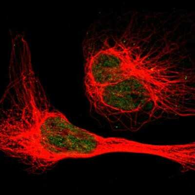Immunocytochemistry/ Immunofluorescence: EIF2AK1 Antibody [NBP1-83210]