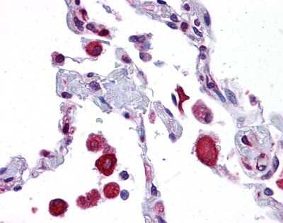 Immunohistochemistry-Paraffin: EIF2AK1 Antibody [NBP1-56484]