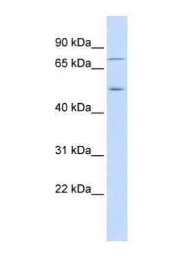 Western Blot: EIF2AK1 Antibody [NBP1-56484]