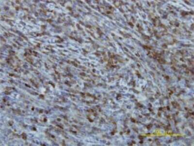 Immunohistochemistry-Paraffin: EIF2B2 Antibody (5B12-E10) [H00008892-M01]