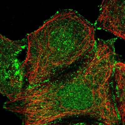 Immunocytochemistry/ Immunofluorescence: EIF2B2 Antibody [NBP2-38572]