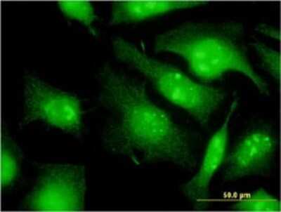 Immunocytochemistry/ Immunofluorescence: EIF2G Antibody (2C9) [H00001968-M01]