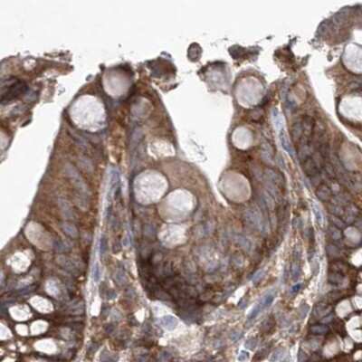 Immunohistochemistry-Paraffin: EIF3A Antibody [NBP1-84875]