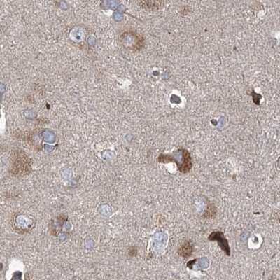 Immunohistochemistry-Paraffin: EIF3A Antibody [NBP1-84875]