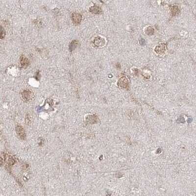Immunohistochemistry-Paraffin: EIF3A Antibody [NBP1-84876]