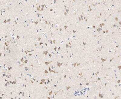 Immunohistochemistry-Paraffin: EIF3A Antibody [NBP3-12794]