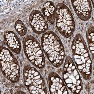 Immunohistochemistry-Paraffin: EIF3C Antibody [NBP2-46741]