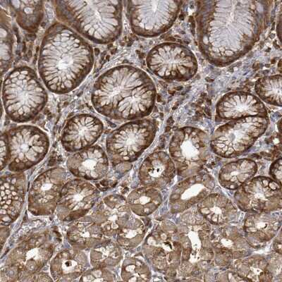 Immunohistochemistry-Paraffin: EIF3C Antibody [NBP2-46772]