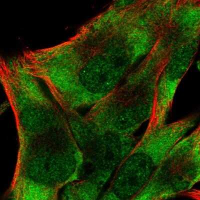 Immunocytochemistry/ Immunofluorescence: EIF3D Antibody [NBP2-39069]