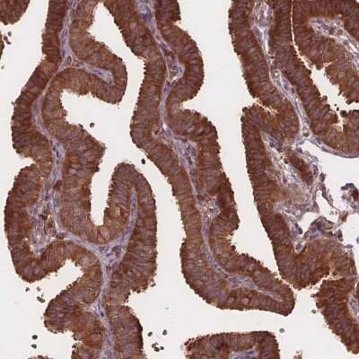 Immunohistochemistry-Paraffin: EIF3D Antibody [NBP2-39069]