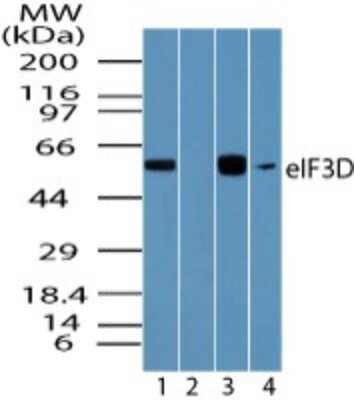 Western Blot: EIF3D Antibody [NBP2-24468]