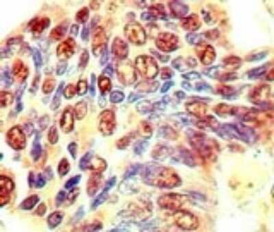 Immunohistochemistry-Paraffin: EIF3J Antibody [NBP2-24572]