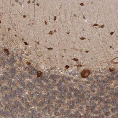 Immunohistochemistry-Paraffin: EIF3S3 Antibody [NBP1-84870]