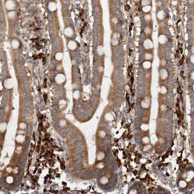 Immunohistochemistry-Paraffin: EIF3S3 Antibody [NBP1-84870]