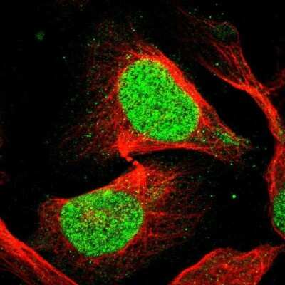Immunocytochemistry/ Immunofluorescence: EIF4A3 Antibody [NBP1-85268]