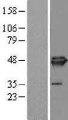 Western Blot: EIF4A3 Overexpression Lysate [NBL1-10203]