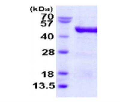 SDS-PAGE: Recombinant Human EIF4A3 His Protein [NBP1-78833]