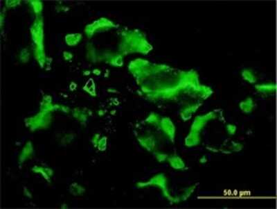 Immunocytochemistry/ Immunofluorescence: EIF4E2 Antibody (4G10) [H00009470-M01]