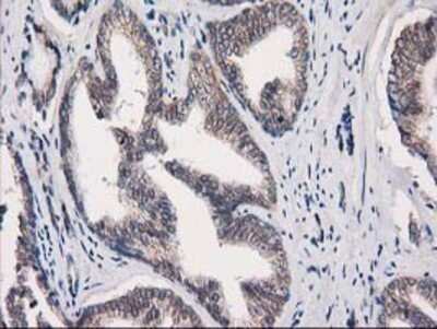 Immunohistochemistry: EIF4E2 Antibody (OTI1F11) - Azide and BSA Free [NBP2-71468]