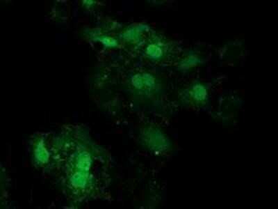 Immunocytochemistry/ Immunofluorescence: EIF4E2 Antibody (OTI1F11) [NBP2-03611]