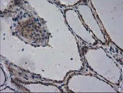 Immunohistochemistry-Paraffin: EIF4E2 Antibody (OTI1F11) [NBP2-03611]