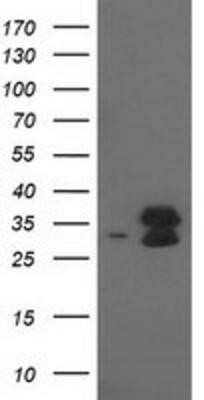 Western Blot: EIF4E2 Antibody (OTI1F11) [NBP2-03611]