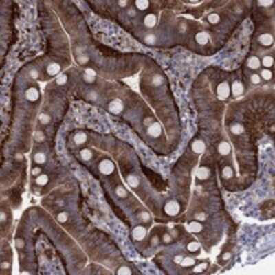 Immunohistochemistry-Paraffin: EIF4E3 Antibody [NBP3-17244]