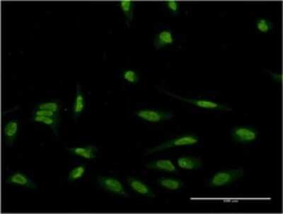Immunocytochemistry/ Immunofluorescence: EIF4EBP3 Antibody (4C1) [H00008637-M05]