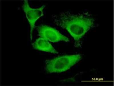 Immunocytochemistry/ Immunofluorescence: EIF5 Antibody (2E6-4C12) [H00001983-M01]