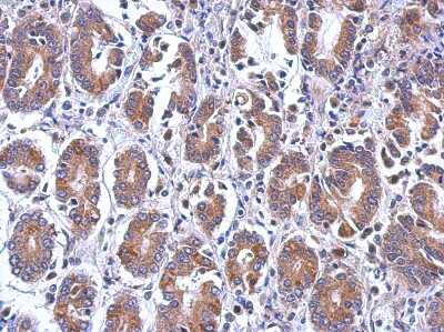 Immunohistochemistry-Paraffin: EIF5 Antibody [NBP2-16311]
