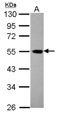 Western Blot: EIF5 Antibody [NBP2-16311]