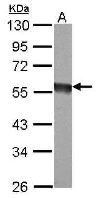 Western Blot: EIF5 Antibody [NBP2-16311]