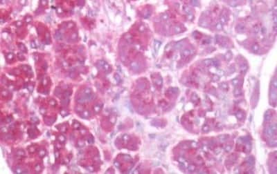 Immunohistochemistry-Paraffin: EIG121 Antibody [NBP3-14303]