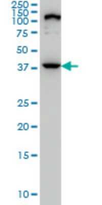 Western Blot: ELAC1 Antibody (1G2) [H00055520-M01]
