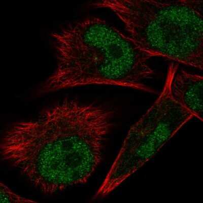 Immunocytochemistry/ Immunofluorescence: ELAC1 Antibody [NBP2-57039]