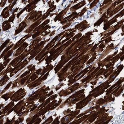 Immunohistochemistry-Paraffin: ELAC1 Antibody [NBP1-85337]
