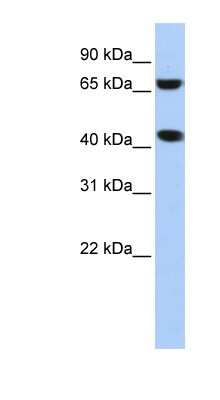 Western Blot: ELAC1 Antibody [NBP1-55326]